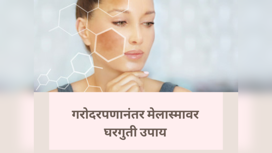 डिलिव्हरीनंतर चेहऱ्यावर दिसणाऱ्या Melasma वर रामबाण उपाय