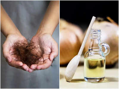 <strong></strong>Onion Hair Oil: পেঁয়াজের তেল ২ দিন লাগালেই চুল ওঠা বন্ধ হয়, বাড়িতেই কীভাবে বানাবেন? জেনে নিন