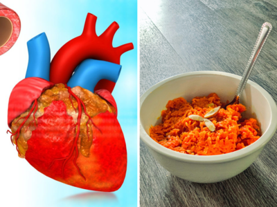 Cholesterol In Winter: ठंड में दोगुना रफ्तार से बढ़ता है कोलेस्ट्रॉल, न खाएं ये 6 चीजें वरना आ जाएगा हार्ट अटैक