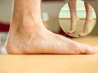 Flat Foot Exercises:नॉर्मल नहीं फ्लैट फूट, चाल में बदलाव जैसे लक्षण कर देंगे परेशान, इन 5 एक्सरसाइज से करें ठीक
