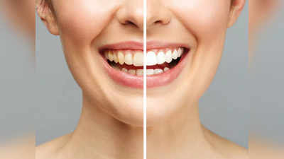 Teeth Whitening Powder: ડેન્ટિસ્ટના ભારેખમ બિલથી બચો, ઘરે માત્ર 20 રૂ.માં બનાવો આયુર્વેદિક પાઉડર; દાંત બનશે દૂધ જેવા સફેદ