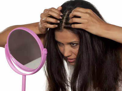 Simple Remedies For Dandruff: താരന്‍ ആകറ്റാന്‍ ഇതാ 4 സൂപ്പര്‍ വഴികള്‍