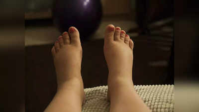 Swollen Feet During Pregnancy: ప్రెగ్నెన్సీ టైమ్‌లో కాళ్ల వాపులు.. ఎలా తగ్గుతాయ్..!