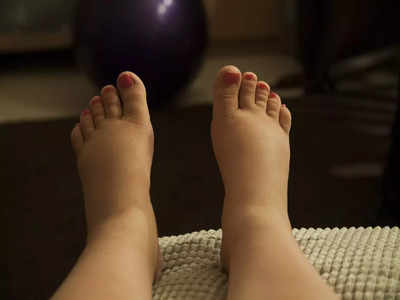 Swollen Feet During Pregnancy: ప్రెగ్నెన్సీ టైమ్‌లో కాళ్ల వాపులు.. ఎలా తగ్గుతాయ్..!