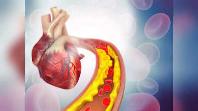 Cholesterol: ঠান্ডায় কোলেস্টেরল বেড়ে যায় দ্বিগুণ গতিতে, এই ৬টি জিনিস থেকে দূরে থাকুন নইলে হতে পারে হার্ট অ্যাটাক