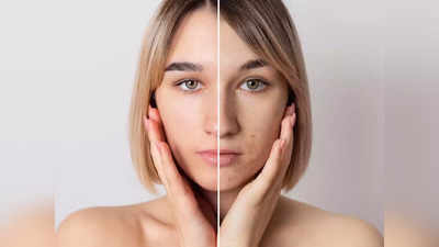 Anti Pigmentation Cream: चेहरे पर मौजूद दाग को कर सकती हैं साफ, महीने भर में मिलेगी स्पॉटलेस हेल्दी स्किन
