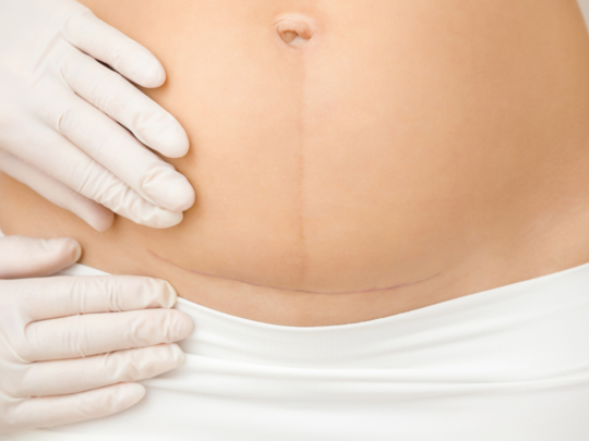 Postpartum belly binding: जानें क्या है डिलीवरी
