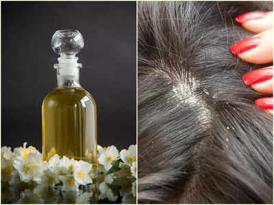 Oiling For Dandruff: তেল মাখলেই সেকেন্ডে হুহু করে বাড়ে খুশকি? আসল সত্যিটা শুনুন বিশেষজ্ঞের মুখেই