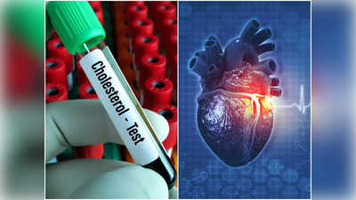 Lipid Profile Test: কোন বয়স থেকে কোলেস্টেরল টেস্ট না করলে হার্ট অ্যাটাক হয়? উত্তর দিলেন চিকিৎসক