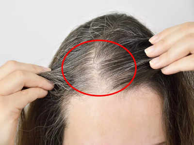 Premature Hair Greying: ৩০ পেরতেই কেন মাথা ভর্তি পাকা চুল? কুচকুচে কালো চুল ফিরবে কীভাবে, জানালেন পুষ্টিবিদ