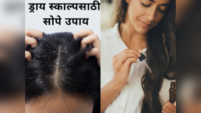 Dry Scalp Remedies: कोरड्या स्काल्पमुळे केस होत असतील खराब तर ट्राय करा हे ५ उपाय