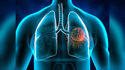 Lung Cancer: এই কয়েকটি লক্ষণই ফুসফুসের ক্যানসারের ইঙ্গিত দেয়, দ্রুত জেনে ব্যবস্থা নিন