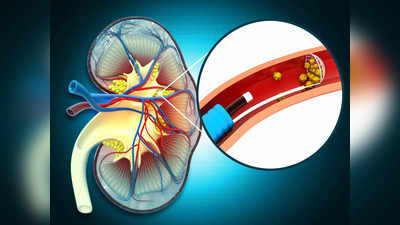 Preventing Kidney Disease: নীরবে থাবা বসাতে পারে কিডনির অসুখ, সুস্থ থাকতে হলে এই অভ্যাসগুলি ছাড়ুন আজই