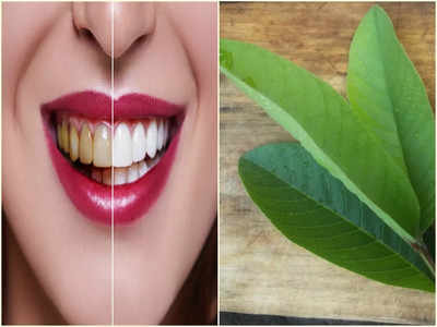 Guava Leaves For Teeth: হলুদ দাঁত সাদা ঝকঝকে করতে চান রাতারাতি? পরিচিত এই পাতা চিবিয়ে নিন মাত্র ১ বার