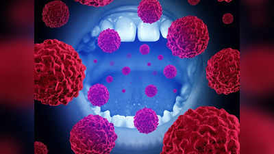 Oral Cancer: মুখে এই লক্ষণ দেখলেই আর অপেক্ষা নয়, ওরাল ক্যানসার থেকে নিজেকে বাঁচাতে জানুন