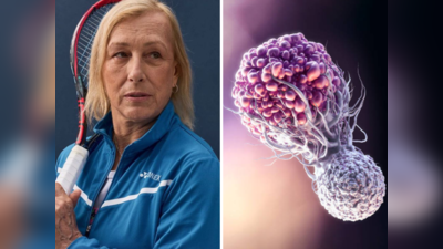 Martina Navratilova टेनिस लीजेंड को हुआ Throat-Breast Cancer, गले में दिखा लक्षण; जानें किसे होता है डबल कैंसर