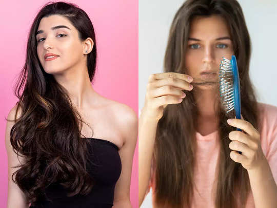 Winter Hair Care Tips In Gujarati : શિયાળામાં શુષ્ક અને ખરતા વાળની સમસ્યા દૂર કરવા જાણો રામબાણ ઇલાજ, Dr.ની 5 ટિપ્સ 