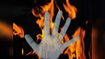 बवाना में आग में बुरी तरह झुलसी महिला, मायके वालों ने दहेज के लिए जलाने का लगाया आरोप