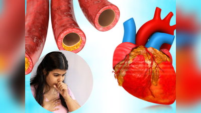 3 कारणों से नसों में भर जाता है गंदा Cholesterol, नहीं दिया ध्यान तो कभी भी आ जाएगा हार्ट अटैक