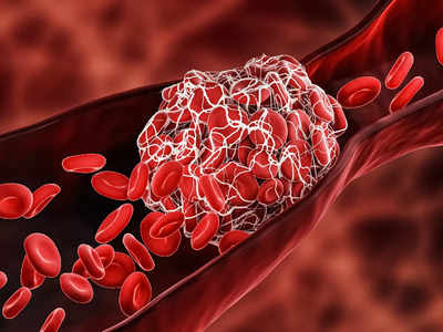 Blood Thickening Foods: ठंड में दोगुनी रफ्तार से गाढ़ा होने लगता है खून, थक्के बनाने वाले इन फूड से रहें दूर