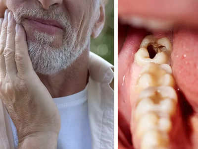 Tooth Pain Relief: শীতের সকালে হঠাৎ দাঁতে ব্যথা? অবহেলা নয়, এই ৩টি ঘরোয়া উপায়েই হবে তাৎক্ষণিক উপশম