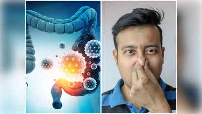 Why Does Stomach Gas Form: কেন পেটে গ্যাস হয়? দুর্গন্ধের কারণ কী? উত্তর দিলেন চিকিৎসক