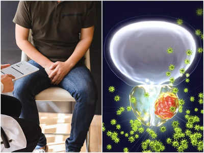 Prostate Cancer: পুরুষ শরীরে এই উপসর্গ ফুটে উঠলেই বুঝবেন প্রস্টেটে ক্যানসারের আশঙ্কা! নিজেকে বাঁচাতে জানুন