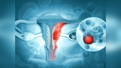 Cervical Cancer: സെര്‍വികല്‍ ക്യാന്‍സര്‍ വരാതെ തടയാം