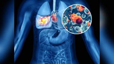 Lung Cancer Symptoms: लंग्स कैंसर में दिखें ये लक्षण, तो समझ जाएं मरीज के पास बचा है सिर्फ 5 महीने का समय