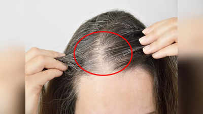 Grey Hair Causes: ৩০ পেরতেই চুলে পাক? এই কয়েকটি সাধারণ ভুলই কিন্তু দায়ী হতে পারে