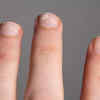 Gross or grunge? Chipped nails to become a hot trend - Times of India