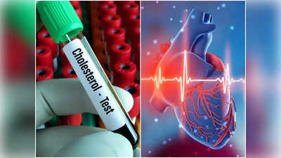 Cholesterol Deposits On The Heart: হার্টের করোনারি আর্টারিতে জমে প্রাণ কাড়ে খারাপ কোলেস্টেরল, এই লক্ষণে সতর্ক হতে বললেন চিকিৎসক