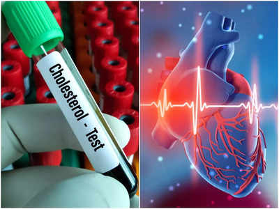 Cholesterol Deposits On The Heart: হার্টের করোনারি আর্টারিতে জমে প্রাণ কাড়ে খারাপ কোলেস্টেরল, এই লক্ষণে সতর্ক হতে বললেন চিকিৎসক