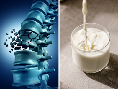 Milk Side Effects: ज्यादा दूध पीने से टूटने लगती हैं हड्डियां, जानें एक दिन में उम्र के हिसाब से कितना पीना चाहिए मिल्क