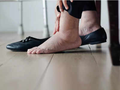 Diabetes Foot Ulcers : షుగర్ పేషెంట్స్‌కి కాళ్ళపై గాయాలు అయితే ప్రమాదమా..