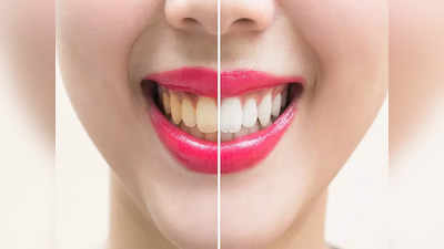 Teeth Whitening Foods: ఈ ఆహారం తింటే.. మీ పళ్లు మిలమిల మెరిసిపోతాయ్‌..!