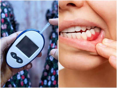 Diabetes Symptoms On Body: এই ৬ অঙ্গ চিৎকার করে বলে আপনার হয়েছে ডায়াবিটিস, লক্ষণের দিকে না তাকালে বাড়বে ব্লাড সুগার