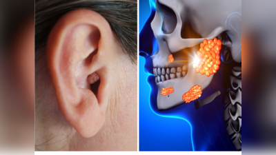 कान की रसौली का इलाज क्या है? कान की हड्डियां तोड़कर बहरा कर देगी छोटी गांठ, तुरंत करें ये 5 काम