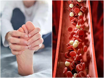 Symptoms of Gout: শরীরের কোথায় কোথায় আক্রমণ শানায় গাউট? ইউরিক অ্যাসিড নিয়ে সব প্রশ্নর উত্তর দিলেন চিকিৎসক