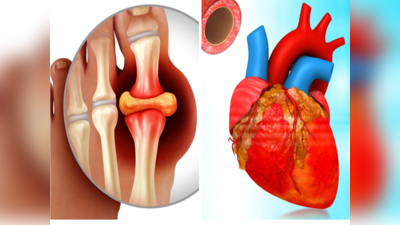 Uric Acid बढ़ने से आ सकता है हार्ट अटैक, Harvard ने माना- खून से यूरिक एसिड निकालेंगी ये 6 चीजें