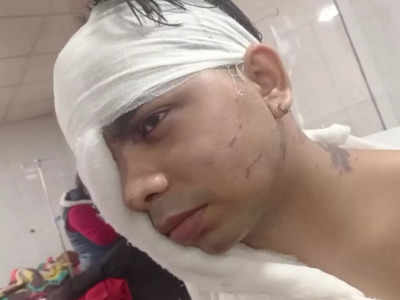 Lucknow Acid Attack: गोमती नगर के घर में घुसकर बदमाशों ने दिखाई दबंगई, मां-बेटे पर तेजाब फेंक हुए फरार