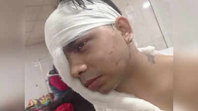 Lucknow Acid Attack: गोमती नगर के घर में घुसकर बदमाशों ने दिखाई दबंगई, मां-बेटे पर तेजाब फेंक हुए फरार