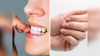 Nail Biting: नाखून चबाने की आदत को इन 4 तरीकों से करें खत्म, हाथ दिखेंगे सुंदर और मिलेगी तारीफ भी
