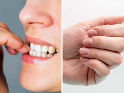 Nail Biting: नाखून चबाने की आदत को इन 4 तरीकों से करें खत्म, हाथ दिखेंगे सुंदर और मिलेगी तारीफ भी