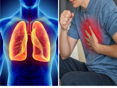 सांस की नली सिकोड़ देती है COPD, फेफड़ों को चूस लेते हैं खांसी जैसे 10 लक्षण, Dr. ने बताए बचने के 4 उपाय