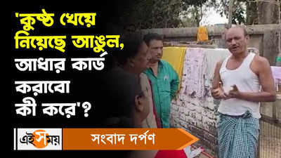 Medinipur News: ‘কুষ্ঠ খেয়ে নিয়েছে আঙুল, আধার কার্ড করাবো কী করে?, উত্তরে কী বললেন জেলাশাসক