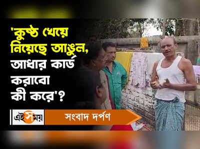 Medinipur News: ‘কুষ্ঠ খেয়ে নিয়েছে আঙুল, আধার কার্ড করাবো কী করে?, উত্তরে কী বললেন জেলাশাসক