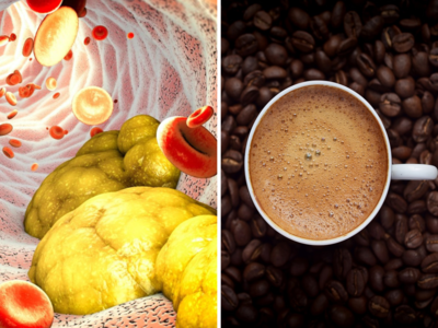 सुबह कॉफी पीने से बेलगाम हो जाएगा कोलेस्ट्रॉल, खतरा टालने के लिए एक्सपर्ट ने बताए 5 उपाय