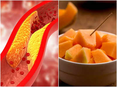 Fruits For Cholesterol Control: খারাপ কোলেস্টেরলের যম এই ৫ ফল! খেলে হার্ট থাকবে সুস্থ, মত পুষ্টিবিদের
