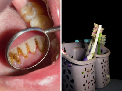 दांत साफ करने के लिए ऐसा टूथब्रश करना चाहिए इस्तेमाल, डॉक्टर भी इन ओरल हेल्थ टिप्स का रखते हैं ध्यान